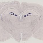 Label Histologie participe à la cartographie de 78 récepteurs orphelins couplés aux protéines G dans le cerveau de souris
