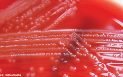 Pathofood vise à prédire le comportement des pathogènes